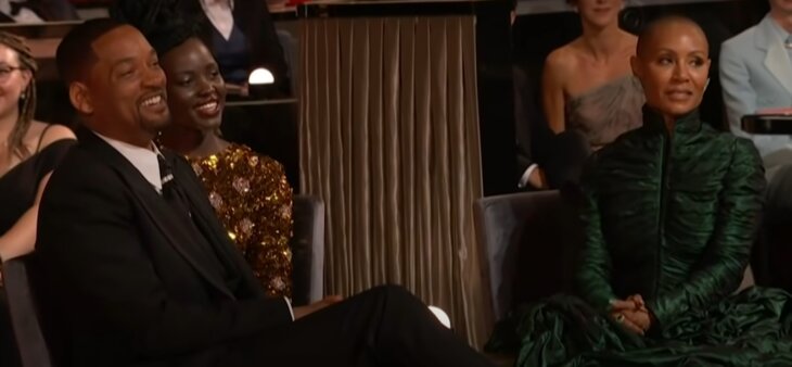 džejda pinket smit alopecija